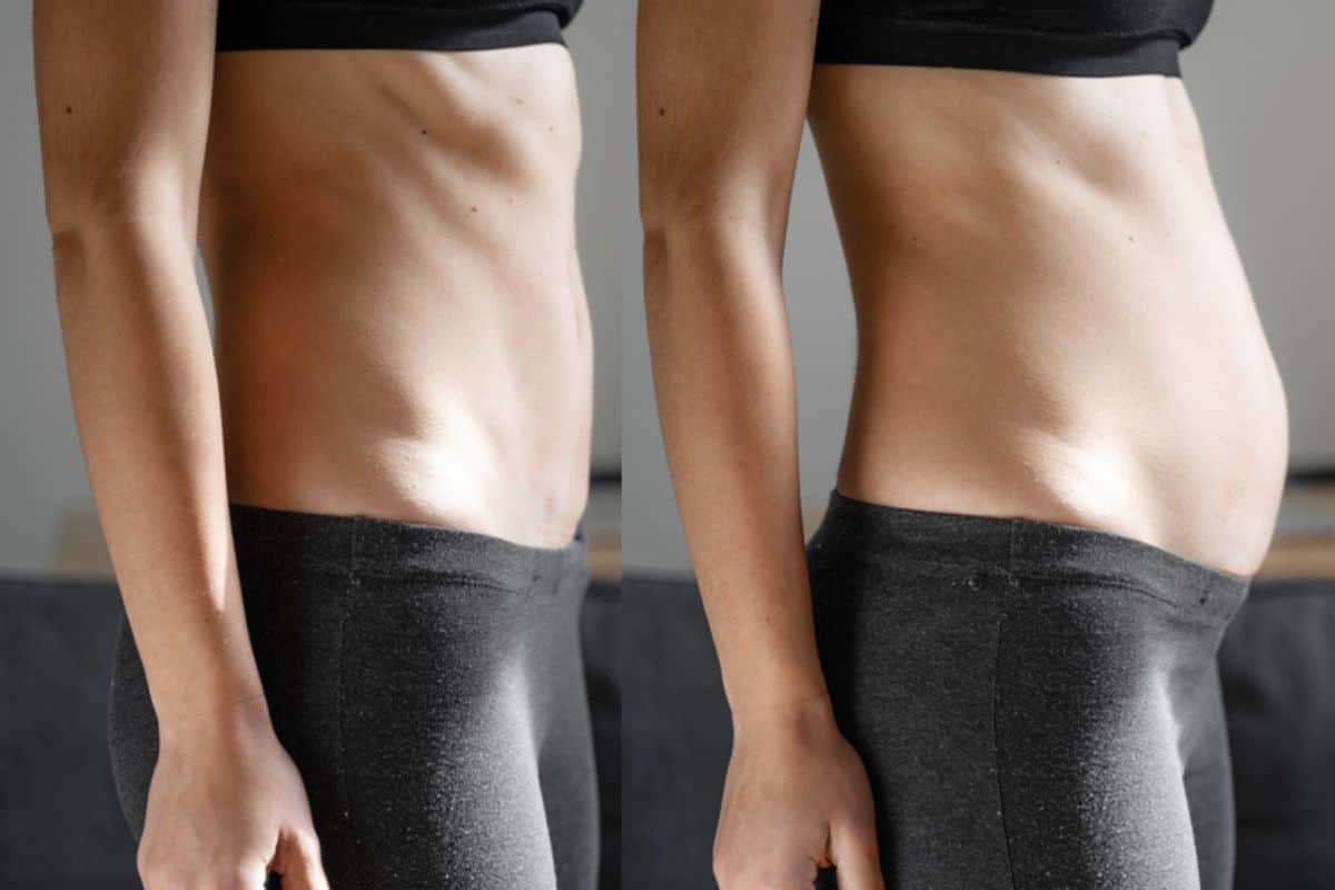 How long does diastasis recti take to improve Farnham?