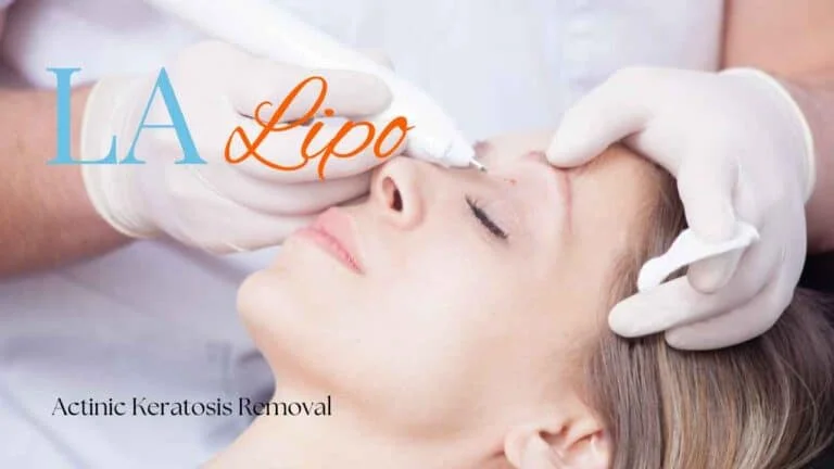 Woman receiving Actinic Keratosis Removal Treatment Farnham