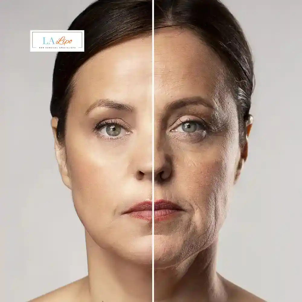 How Can You Tell If Non-Surgical Skin Tightening Is Right for You Farnham?
