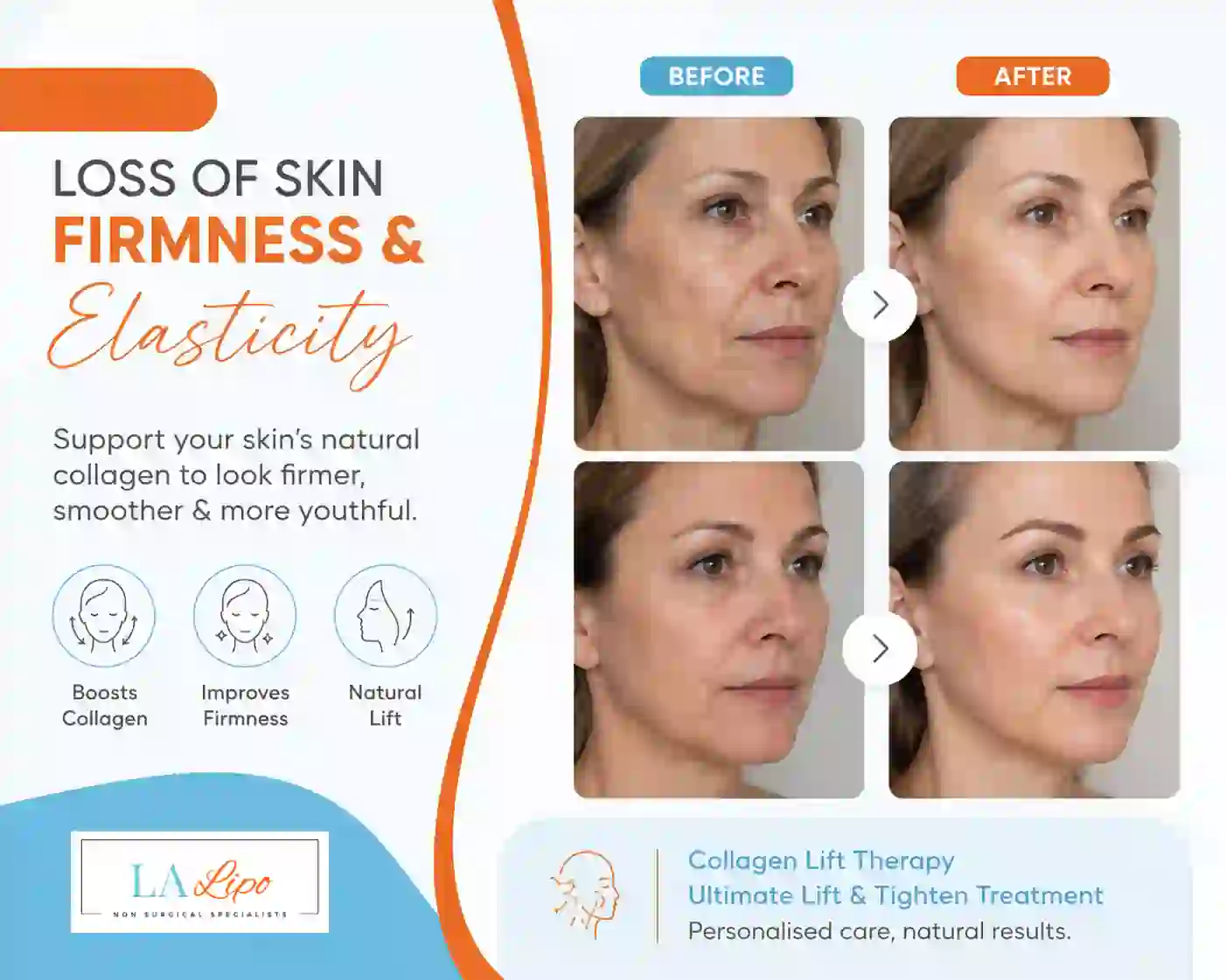 Sign #7: Loss of Skin Firmness and Elasticity Farnham