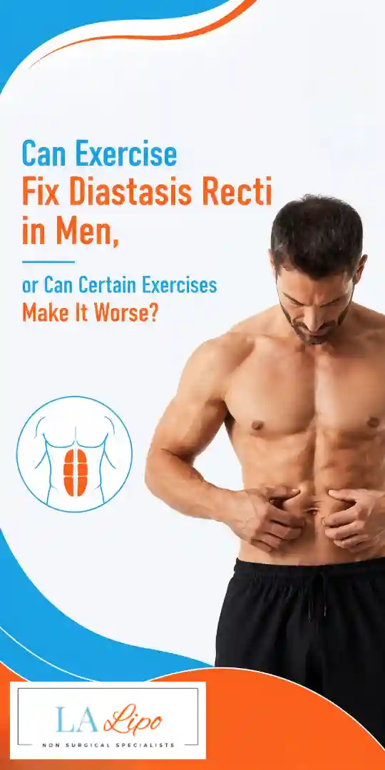 Can Exercise Fix Diastasis Recti in Men, or Can Certain Exercises Make It Worse Farnham?