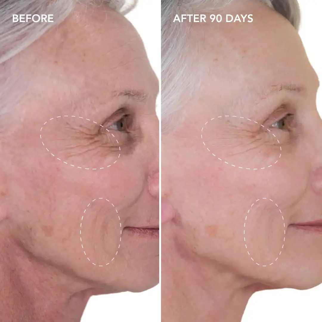 When will you see results Farnham